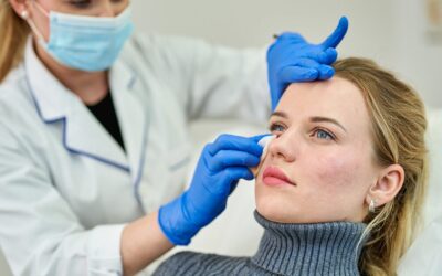 Aknés bőr kezelése