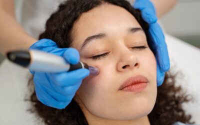 Mikrotűs kezelés mélyhámlasztással